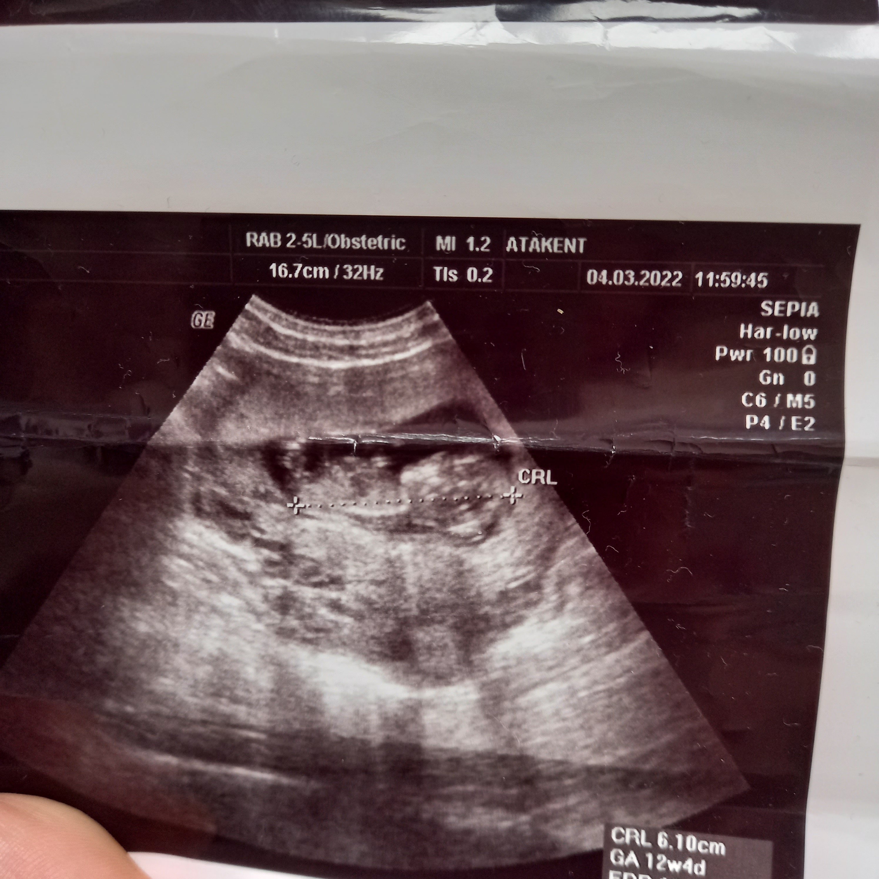 16465714180107623577393154452873-jpg.89439