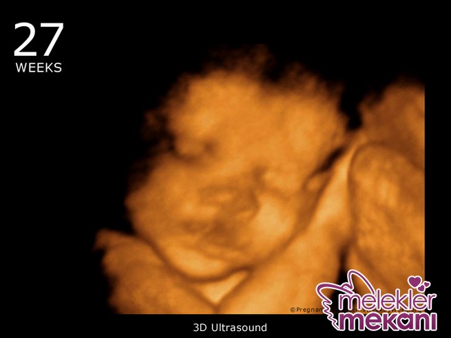 27_week_ultrasound_3d.JPG