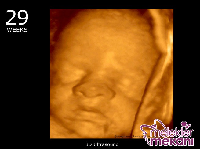 29_week_ultrasound_3d.JPG