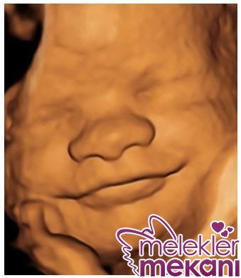 31 haftalik fetus 3d ultrason.jpg