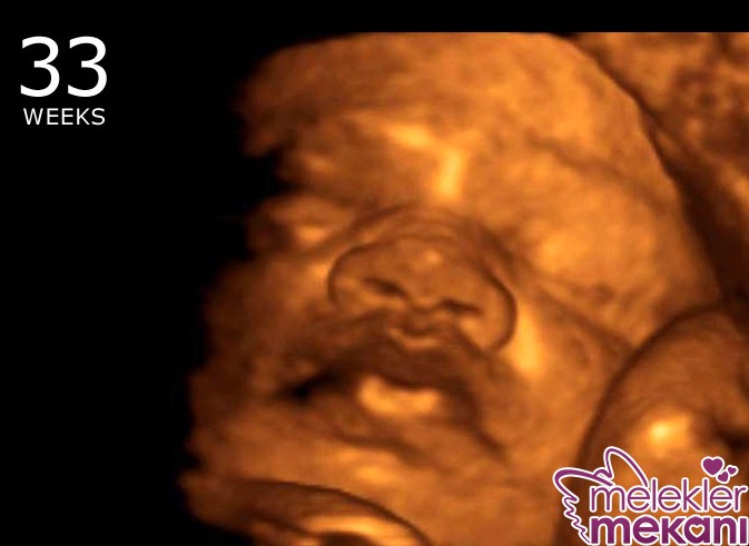 33 haftalik bebek 3d ultrason.jpg