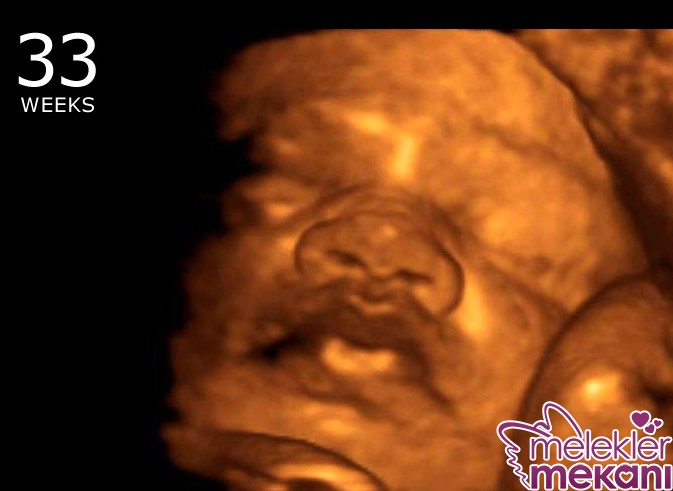 33 haftalik bebek 3d ultrason.jpg