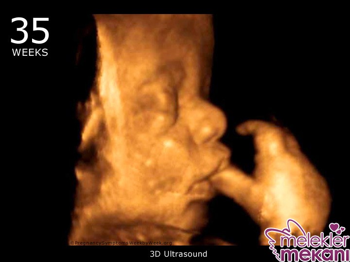 35 haftalik bebek 3d ultrason goruntusu.jpg