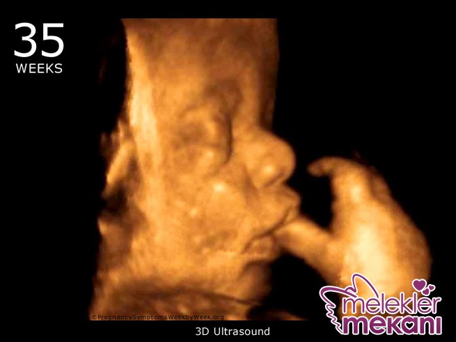 35_week_ultrasound_3d.JPG