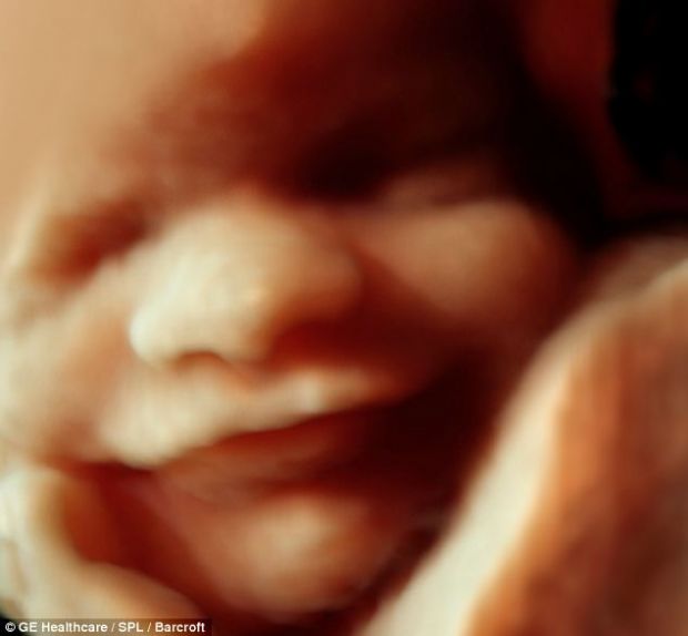 3d 40 haftalık bebek görünümü ultrasonda.jpg