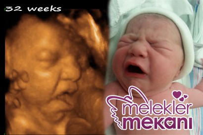 3D-ultrasound-before-and-after-crying.JPG