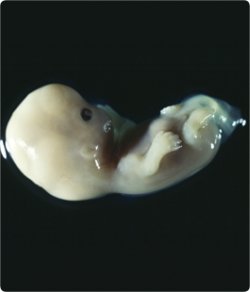 5 haftalık embriyo.jpg