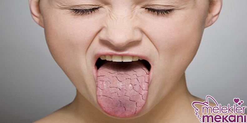 ağız kuruluğu.jpg