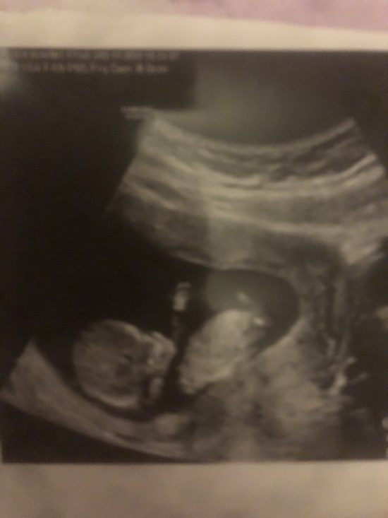 bebeğimin cinsiyeti ne.jpg