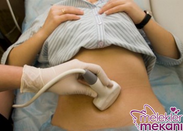 bebek kesesi ilk ne zaman gorulur.jpg