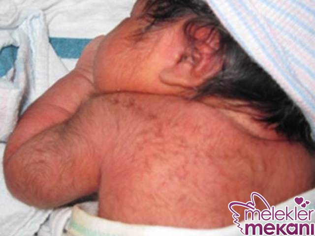 bebeklerde tuyler ne zaman dokulur.jpg