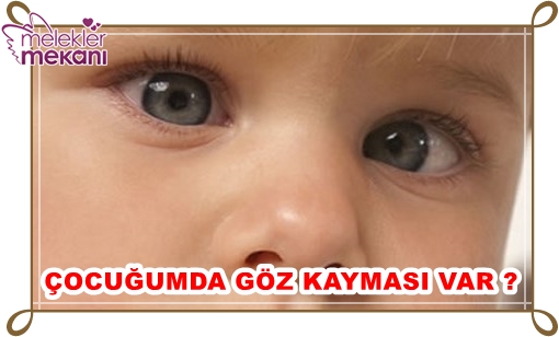 çocuklarda göz kayması yaşayanlar.jpg