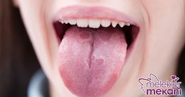 dil kökünde kabarcık çıkması.jpg