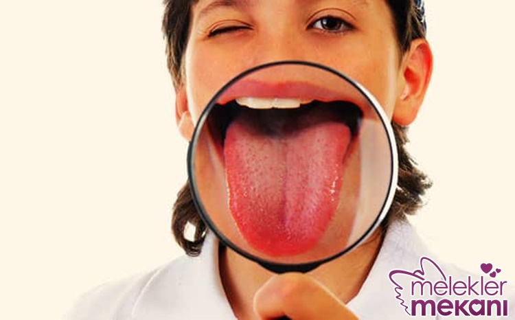 dilde kabarcık neden çıkar.jpg