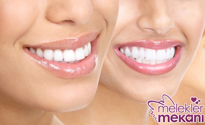 diş beyazlatma.jpg