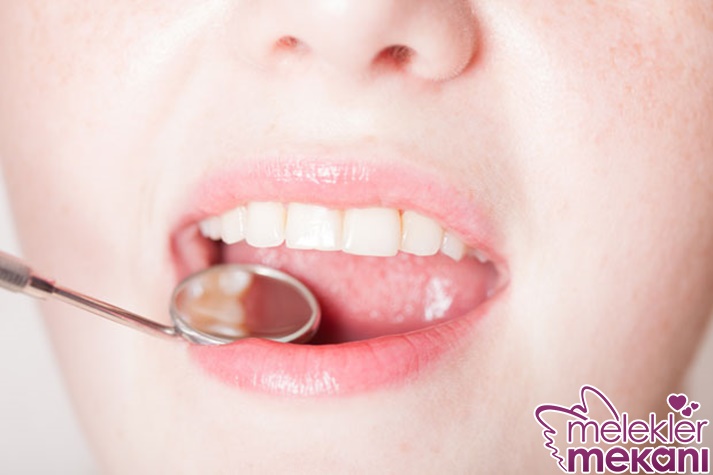 diş eti hassasiyeti.jpg