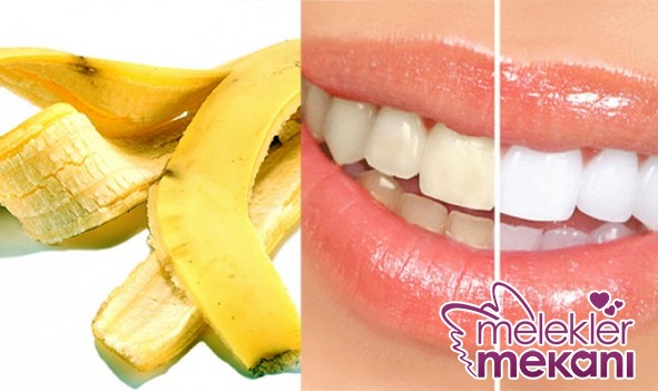 disleri_beyazlatmak_icin_muz_kabugu_yontemi_1477142476_8325.JPG