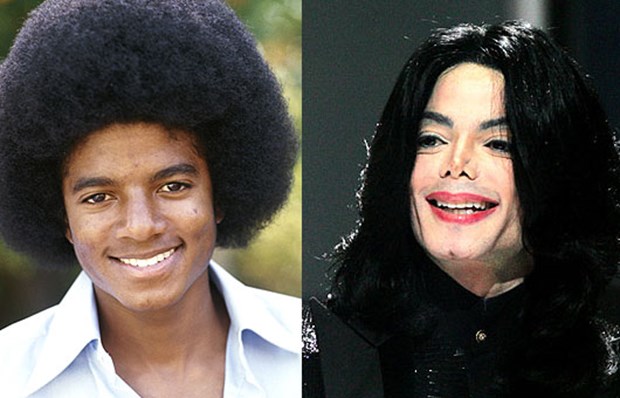 Estetik-ameliyatları-abartıp-korkunç-bir-başkalaşım-geçirmiş-ünlülerden-Michael-Jackson.jpg