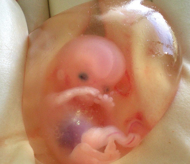 gebelikte 9. hafta.jpg