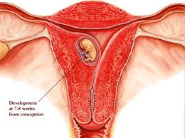 gebelikte yerleşmem kanaması nasıl anlaşılır.jpg