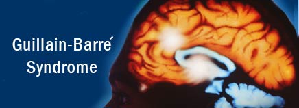 guillain-Barre.jpg