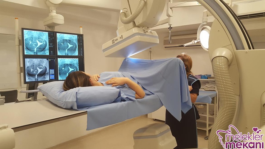 Histerosonografi Nedir.jpg