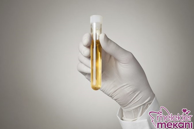 idrarda lökosit.jpg