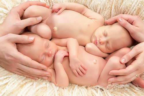 ikiz bebeğini kaybedenler.png