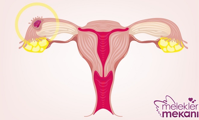 implantasyon kanaması.jpg