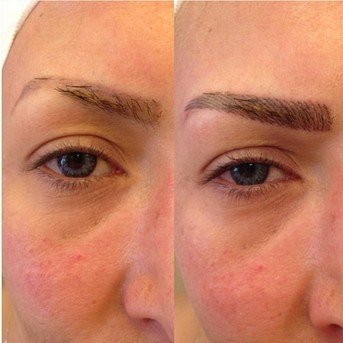 kıl tekniği (2).jpg