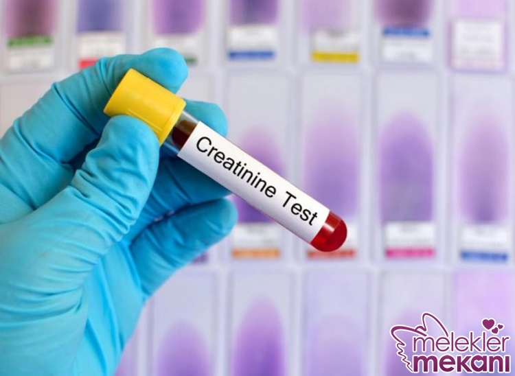 kreatinin yükseliği nedir.jpg