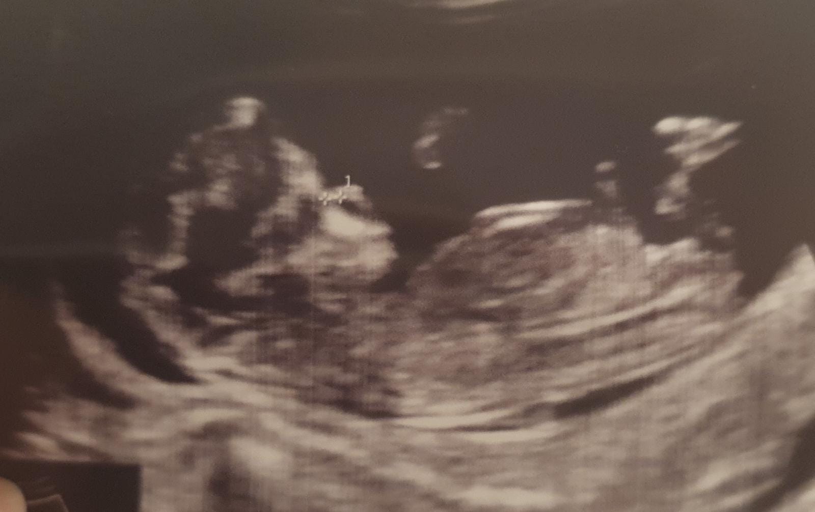 nub teorisi cinsiyet belirleme.jpg