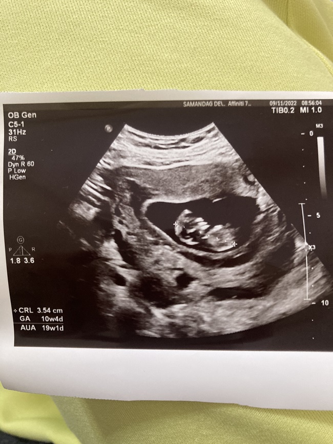 nub teorisine göre bebek cinsiyeti.jpg