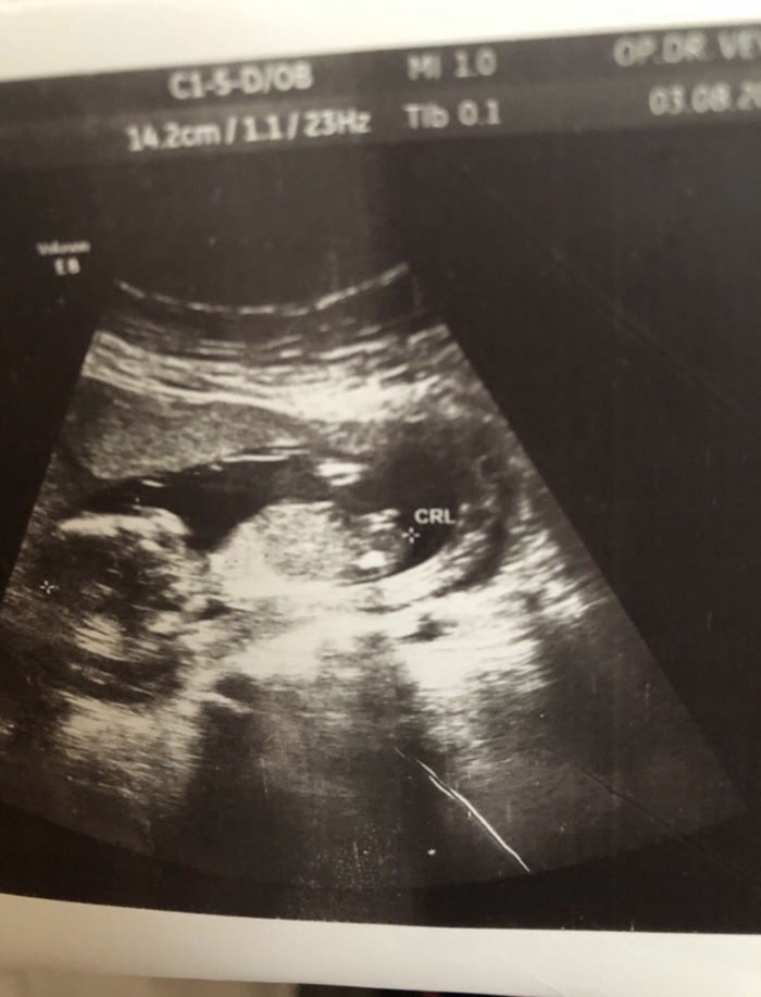 nuba göre cinsiyet tahmini erkek mi kız mı.jpg