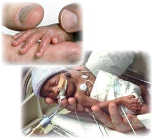 premature-bebek_ (11).jpg