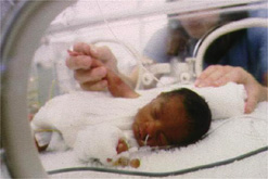 premature-bebek_ (13).jpg