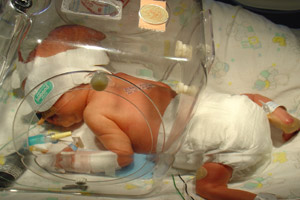 premature-bebek_ (16).jpg