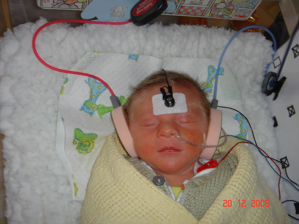 premature-bebek_ (17).jpg