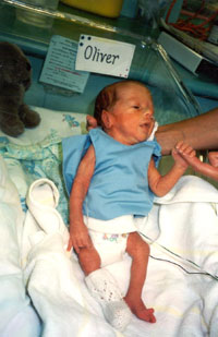 premature-bebek_ (18).jpg