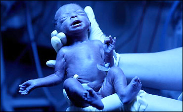 premature-bebek_ (3).jpg