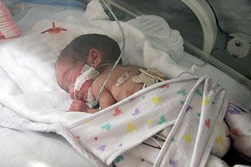 premature-bebek_ (6).jpg