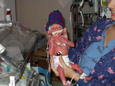 premature-bebek_ (9).jpg