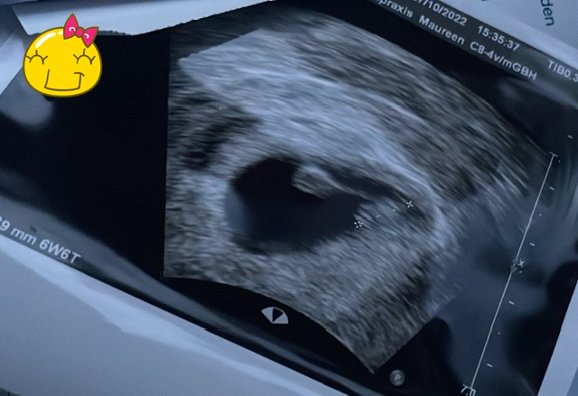 ramzi teorisine göre bebeğimin cinsiyeti nedir.jpg