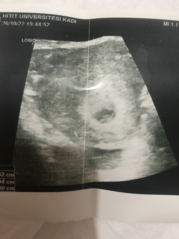 ramzi teorisine göre cinsiyet.jpg