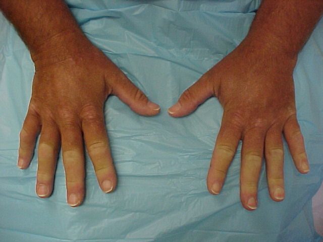 raynaud-184.jpg