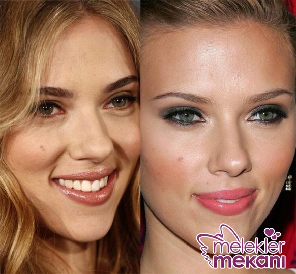 revealing_photos_of_stars_pre_and_post_plastic_surgery_640_07.JPG