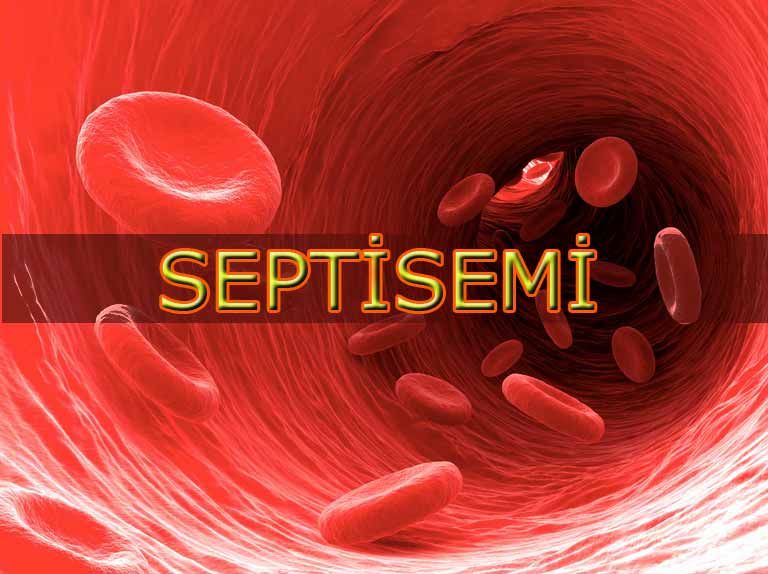 septisemi-nedir-kan-zehirlenmesi.jpg