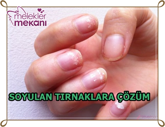 soyulan tirnaklara cözüm.jpg