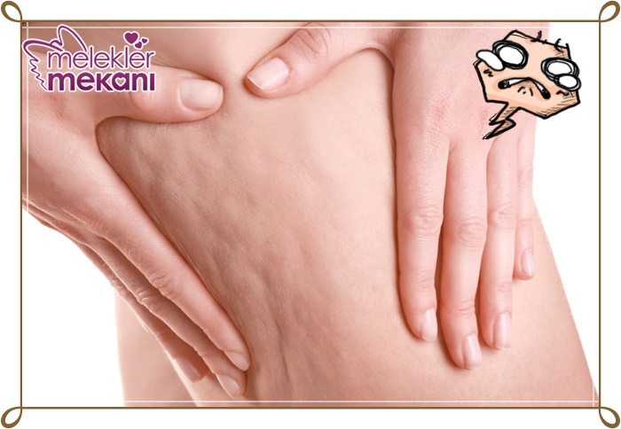 suna dumankaya selülit maskesi.jpg