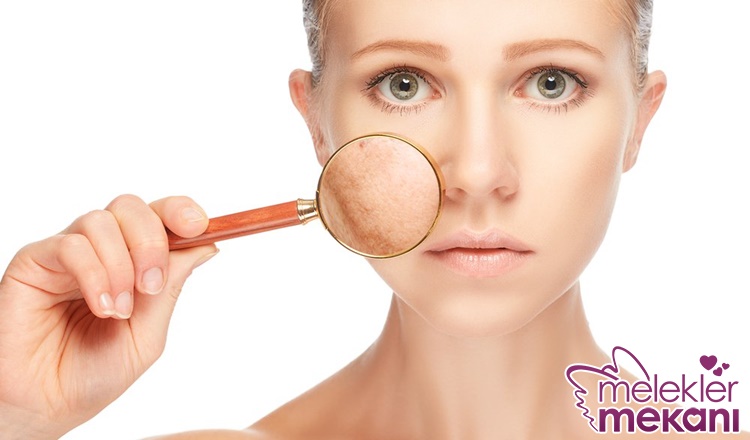 yüz lekeleri için bakım önerileri.jpg